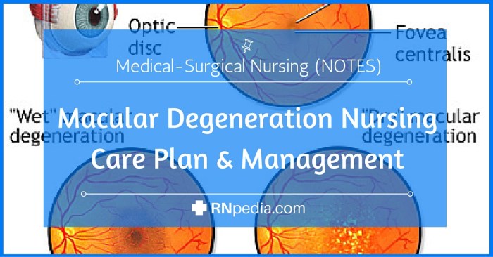 Nursing care plan for macular degeneration