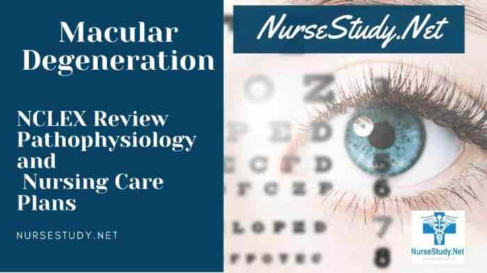 Nursing care plan for macular degeneration